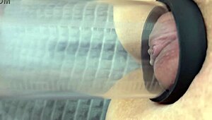 我用真空泵肿胀逼然后用力抠