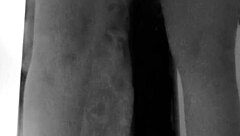 グレタラが足と胸と尻を見せる