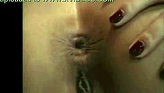 In a casual tale, the asshole blinks playfully.