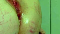 Cewek Brondong Ngentot Bokong Brutal di Sesi Terapi Anal Sakit