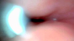 An endoscope camera records the close-up view of male ejaculation in real time.