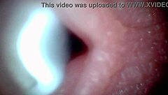 An endoscope camera records the close-up view of male ejaculation in real time.