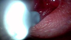 An endoscope camera records the close-up view of male ejaculation in real time.