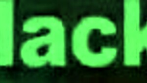 Amatør sort teenager med bøjler får hård anal pounding, wow!