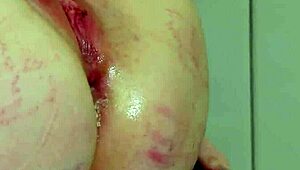Napalona laska dostaje brutalne rżnięcie w dupę podczas bolesnej terapii analnej.