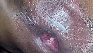 that venezuelan milf's ass got sodomized so hard it gaped wide open whoa