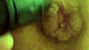 Vacuum sucks my prolapsed anal lips while I jerk off hard