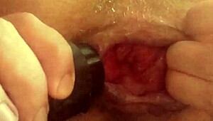 Vacuum sucks my prolapsed anal lips while I jerk off hard